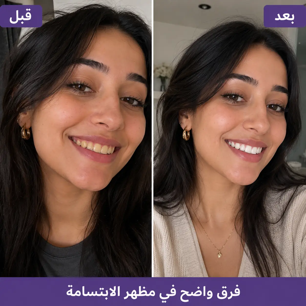 قبل وبعد